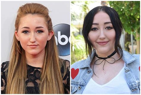 noah cyrus plastic surgery|The Stunning Transformation Of Noah Cyrus